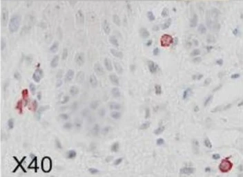 Anti-NKp46 antibody [8F24] used in IHC (Paraffin sections) (IHC-P). GTX52945