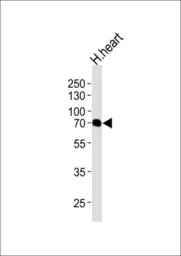 Anti-CLPX antibody used in Western Blot (WB). GTX53477