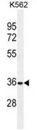 Anti-FOXI3 antibody used in Western Blot (WB). GTX53545