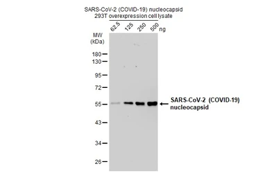 SARS-CoV-2 (COVID-19) Nucleocapsid overexpression 293T whole cell lysate. GTX535665