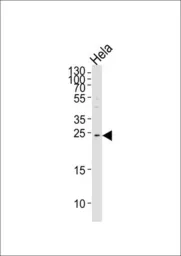 Anti-HCCA2 antibody used in Western Blot (WB). GTX53605