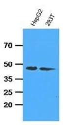 Anti-Adenosine kinase antibody [AT4F8] used in Western Blot (WB). GTX53683