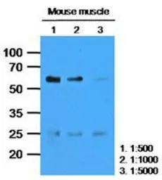 Anti-Calsequestrin 2 antibody [AT4E10] used in Western Blot (WB). GTX53693