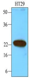 Anti-CIB1 antibody [1D1] used in Western Blot (WB). GTX53699