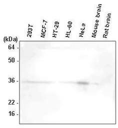 Anti-HTRA2 antibody [1B3] used in Western Blot (WB). GTX53729