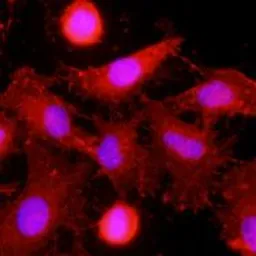 Anti-CLEC4E antibody [AT16E3] used in Immunocytochemistry/ Immunofluorescence (ICC/IF). GTX53742