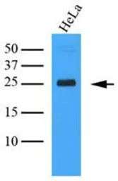 Anti-CLEC4E antibody [AT16E3] used in Western Blot (WB). GTX53742
