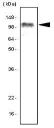 Anti-TLR7 antibody [4F4] used in Western Blot (WB). GTX53802