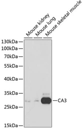 Anti-Carbonic Anhydrase III antibody used in Western Blot (WB). GTX53907
