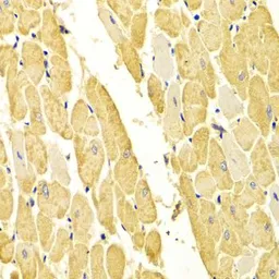 Anti-Carbonic Anhydrase III antibody used in IHC (Paraffin sections) (IHC-P). GTX53907