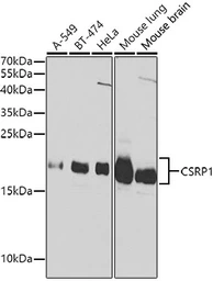 Anti-CSRP1 antibody used in Western Blot (WB). GTX53932