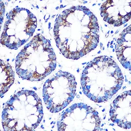 Anti-CYP11A1 antibody used in IHC (Paraffin sections) (IHC-P). GTX53941