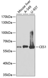 Anti-CES1 antibody used in Western Blot (WB). GTX53943