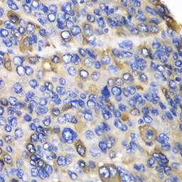 Anti-CES1 antibody used in IHC (Paraffin sections) (IHC-P). GTX53943