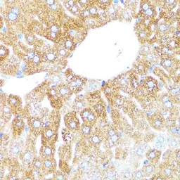 Anti-CYP3A4 antibody used in IHC (Paraffin sections) (IHC-P). GTX53947