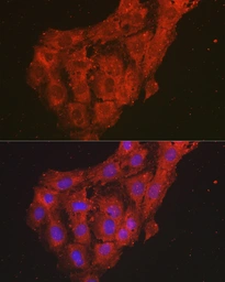 Anti-CXCL1 / GRO alpha antibody used in Immunocytochemistry/ Immunofluorescence (ICC/IF). GTX53966