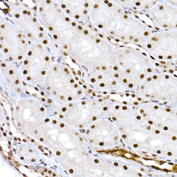 Anti-CREB (phospho Ser133) antibody used in IHC (Paraffin sections) (IHC-P). GTX53975