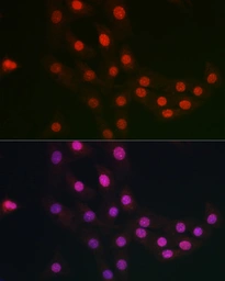 Anti-FANCC antibody used in Immunocytochemistry/ Immunofluorescence (ICC/IF). GTX53977