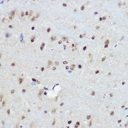 Anti-FANCC antibody used in IHC (Paraffin sections) (IHC-P). GTX53977