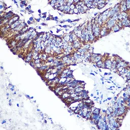 Anti-DOK4 antibody used in IHC (Paraffin sections) (IHC-P). GTX53984