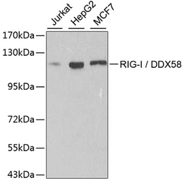 Anti-DDX58 antibody used in Western Blot (WB). GTX54000