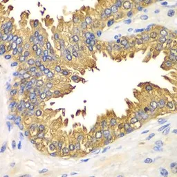 Anti-DDX58 antibody used in IHC (Paraffin sections) (IHC-P). GTX54000