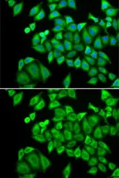 Anti-DHRS9 antibody used in Immunocytochemistry/ Immunofluorescence (ICC/IF). GTX54001