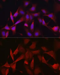 Anti-Ferritin Heavy Chain antibody used in Immunocytochemistry/ Immunofluorescence (ICC/IF). GTX54014