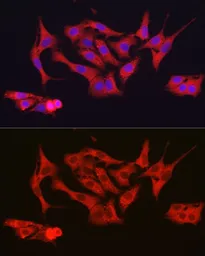 Anti-Ferritin Heavy Chain antibody used in Immunocytochemistry/ Immunofluorescence (ICC/IF). GTX54014