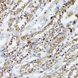 Anti-Ferritin Heavy Chain antibody used in IHC (Paraffin sections) (IHC-P). GTX54014