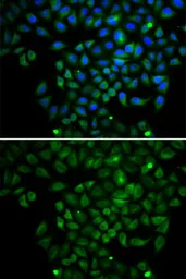 Anti-FABP4 antibody used in Immunocytochemistry/ Immunofluorescence (ICC/IF). GTX54016