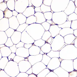 Anti-FABP4 antibody used in IHC (Paraffin sections) (IHC-P). GTX54016