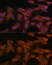 Anti-DDX3 antibody used in Immunocytochemistry/ Immunofluorescence (ICC/IF). GTX54030
