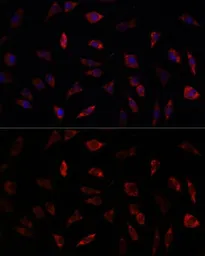 Anti-Frataxin antibody used in Immunocytochemistry/ Immunofluorescence (ICC/IF). GTX54036