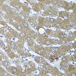 Anti-Frataxin antibody used in IHC (Paraffin sections) (IHC-P). GTX54036