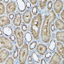 Anti-Frataxin antibody used in IHC (Paraffin sections) (IHC-P). GTX54036