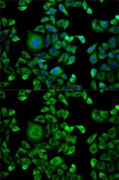 Anti-EXT1 antibody used in Immunocytochemistry/ Immunofluorescence (ICC/IF). GTX54045
