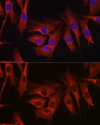Anti-HMGCR antibody used in Immunocytochemistry/ Immunofluorescence (ICC/IF). GTX54088