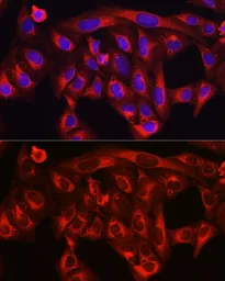 Anti-HMGCR antibody used in Immunocytochemistry/ Immunofluorescence (ICC/IF). GTX54088