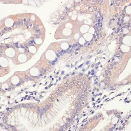 Anti-HMGCR antibody used in IHC (Paraffin sections) (IHC-P). GTX54088
