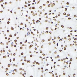 Anti-Histone H3K9me2 (di-methyl Lys9) antibody used in IHC (Paraffin sections) (IHC-P). GTX54102