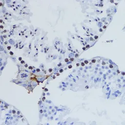Anti-Histone H3K9me3 (tri-methyl Lys9) antibody used in IHC (Paraffin sections) (IHC-P). GTX54103
