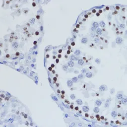 Anti-Histone H3K9me3 (tri-methyl Lys9) antibody used in IHC (Paraffin sections) (IHC-P). GTX54103