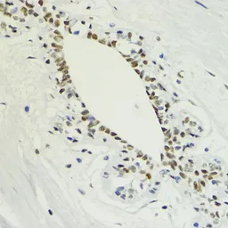 Anti-Histone H3K36me2 (di-methyl Lys36) antibody used in IHC (Paraffin sections) (IHC-P). GTX54108