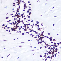 Anti-Histone H3K36me3 (tri-methyl Lys36) antibody used in IHC (Paraffin sections) (IHC-P). GTX54109