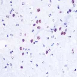 Anti-Histone H3K36me3 (tri-methyl Lys36) antibody used in IHC (Paraffin sections) (IHC-P). GTX54109