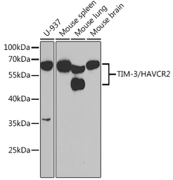 Anti-TIM-3 antibody used in Western Blot (WB). GTX54117
