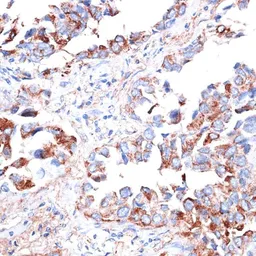Anti-TIM-3 antibody used in IHC (Paraffin sections) (IHC-P). GTX54117
