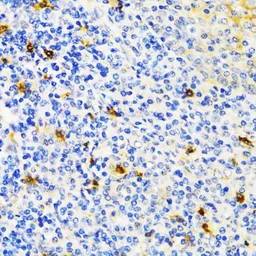 Anti-TIM-3 antibody used in IHC (Paraffin sections) (IHC-P). GTX54117
