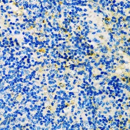 Anti-TIM-3 antibody used in IHC (Paraffin sections) (IHC-P). GTX54117